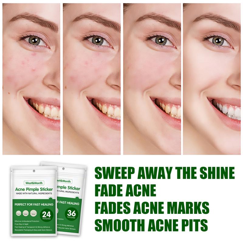 Acne Pimple LANBENA 24/36 Pcs Patch Invisible Stickers and Treatment Pimple Remover Tool