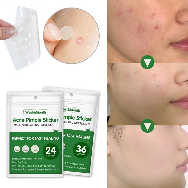 Acne Pimple LANBENA 24/36 Pcs Patch Invisible Stickers and Treatment Pimple Remover Tool